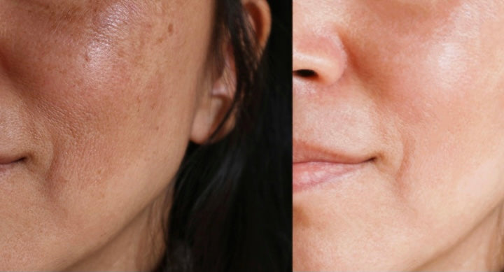 Le Visage SN07